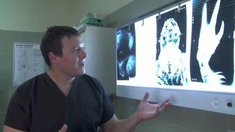 火星异种 revenge